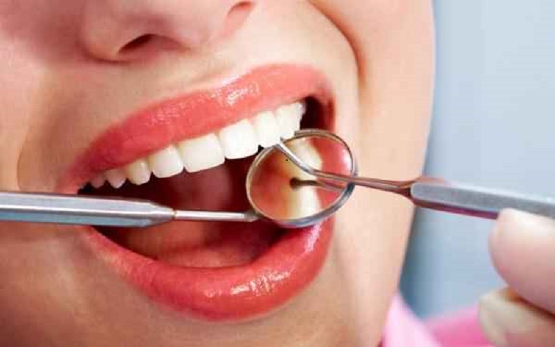 خطاهای ایجاد کننده جرم دندان