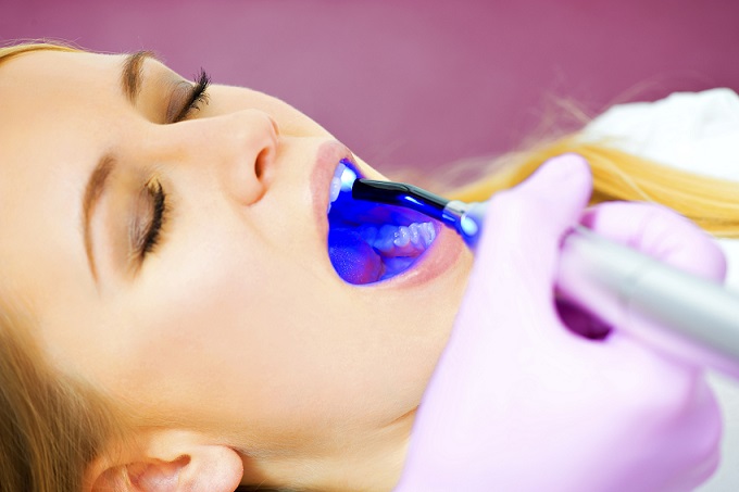 استفاده از لیزر در دندان پزشکی