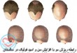 رابطه ریزش مو با افزایش سن و اسید فولیک در سالمندان