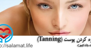 برنزه کردن پوست (Tanning)