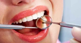 خطاهای ایجاد کننده جرم دندان