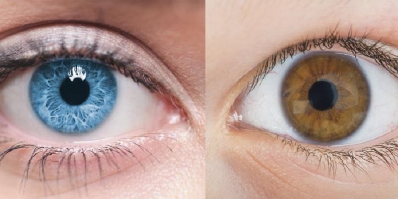 تغییر رنگ چشم با ایمپلنت عنبیه مصنوعی