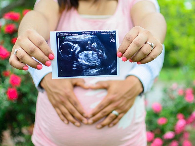 سونوگرافی برای تعیین جنسیت جنین