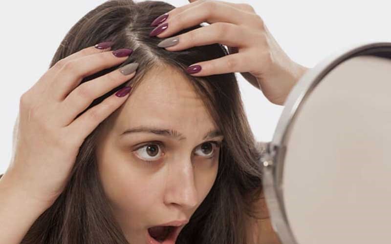 راه های درمان ریزش موی ارثی