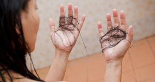 علت ریزش مو بعد از حمام چیست